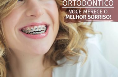 Aparelho Ortodôntico Você Merece O Melhor Sorriso!