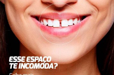 Diastema