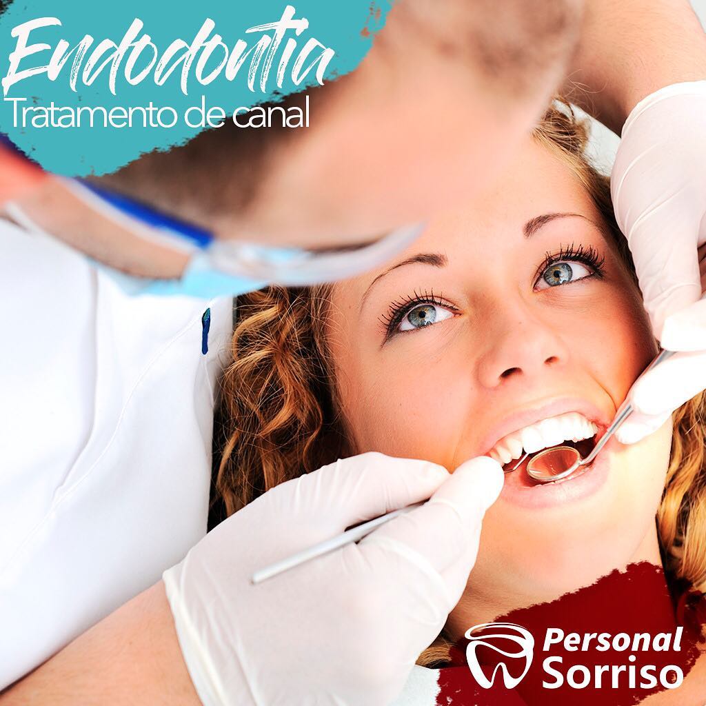 Endodontia Tratamento De Canal Wanessa Paje