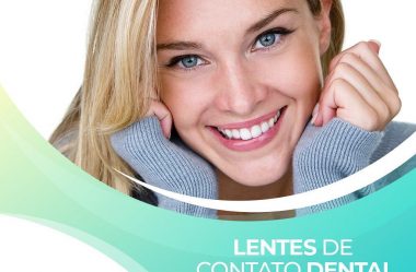 Lentes De Contato Dental.