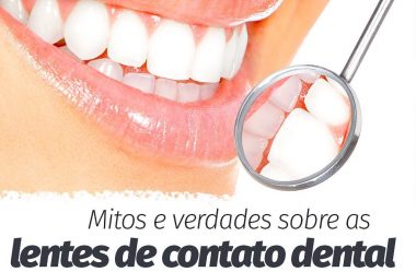 Mitos e Verdades Sobre as Lentes de Contato Dental.