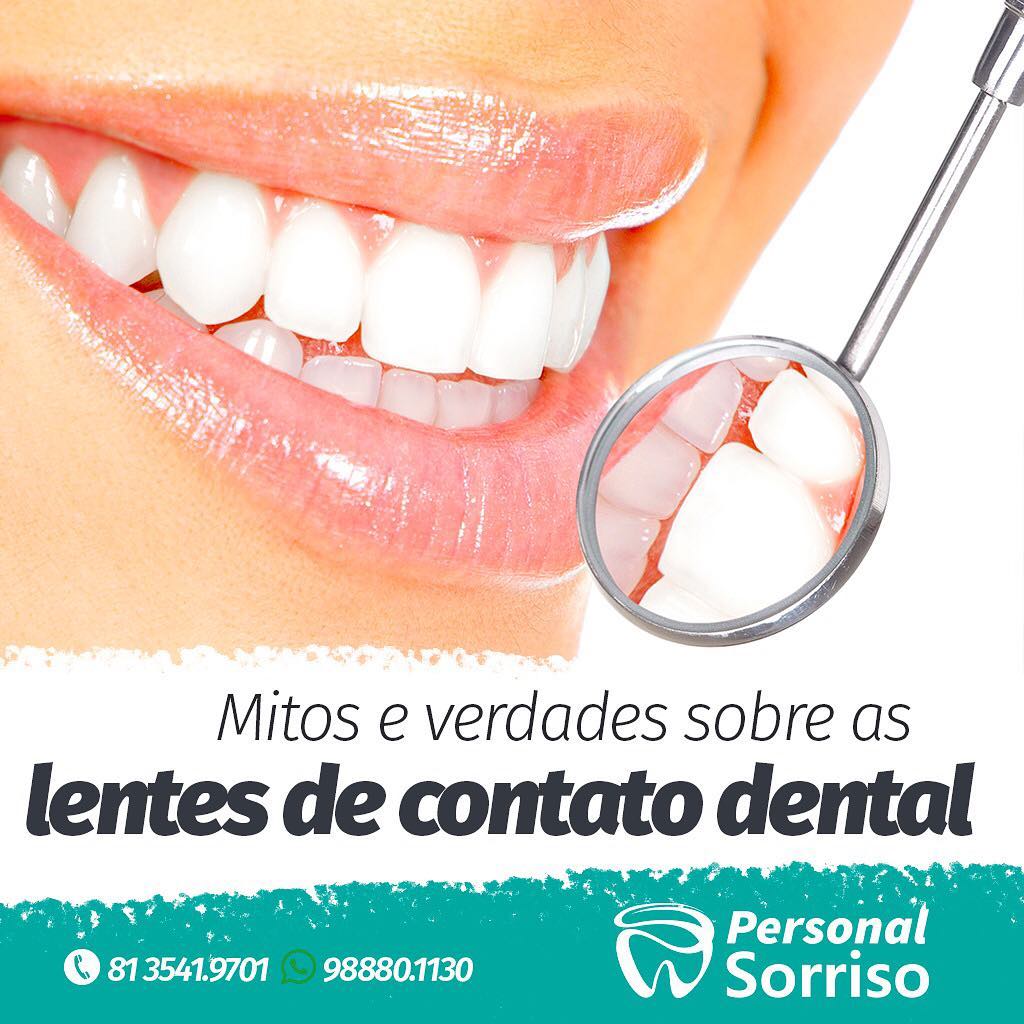 Mitos E Verdades Sobre As Lentes De Contato Dental Wanessa Paje