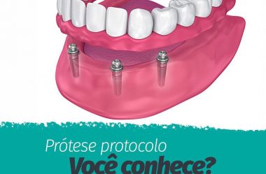 Prótese Protocolo Você Conhece?