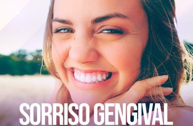 Sorriso Gengival Saiba Corrigir.