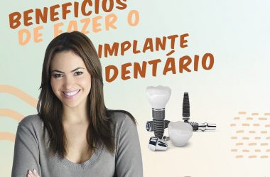 Benefícios de Fazer O Implante Dentário