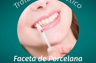 Tratamento Estético Facetas de Porcelanas