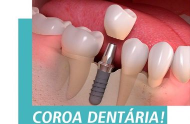 Coroa Dentária!