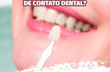 Quem Pode Realizar as Facetas ou Lentes de Contato Dental