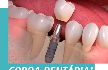 Coroa Dentária!